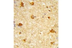 Formalin-fixed and paraffin-embedded human brain tissue reacted with DIRAS1 Antibody , which was peroxidase-conjugated to the secondary antibody, followed by DAB staining. (DIRAS1 antibody  (Middle Region))