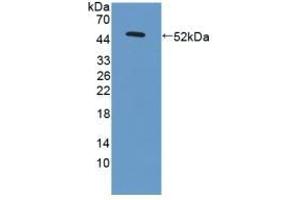 Detection of Recombinant LAMC3, Human using Polyclonal Antibody to Laminin Gamma 3 (LAMC3) (LAMC3 antibody  (AA 901-1100))