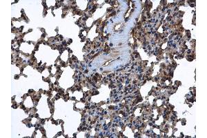 IHC-P Image FARSLA antibody [N2C2], Internal detects FARSLA protein at cytoplasm in mouse lung by immunohistochemical analysis. (Phenylalanyl-tRNA Synthetase, alpha Subunit (FARSA) antibody)