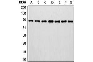 Western blot analysis of Involucrin expression in MCF7 (A), A375 (B), A431 (C), NIH3T3 (D), HT1080 (E), mouse brain (F), rat brain (G) whole cell lysates.