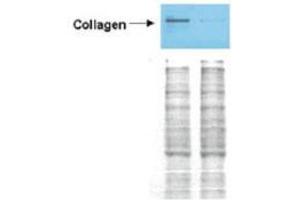Western Blotting (WB) image for anti-COL1A2/COL1A1 antibody (ABIN5596819)