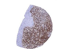 Strong decorin staining of the stroma while urothelium remains unstained in the urinary bladder (Recombinant Decorin antibody  (AA 212-336))