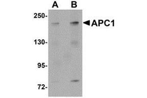 Western blot analysis of APC1 in SK-N-SH cell lysate with AP30057PU-N APC1 antibody at (A) 1 and (B) 2 μg/ml. (APC1 antibody  (C-Term))