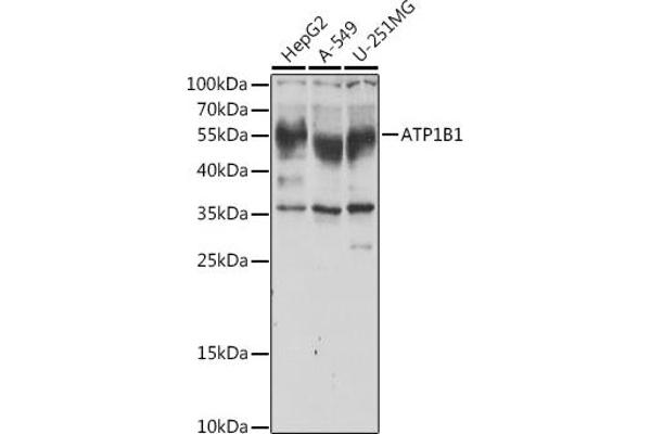 ATP1B1 antibody  (AA 63-303)