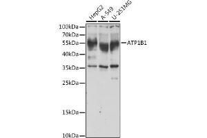 Western blot analysis of extracts of various cell lines, using B1 antibody (ABIN6127389, ABIN6137306, ABIN6137309 and ABIN6221475) at 1:1000 dilution. (ATP1B1 antibody  (AA 63-303))