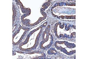 IHC analysis of Kindlin 2/FERMT2 using anti-Kindlin 2/FERMT2 antibody (ABIN7599515). (FERMT2 antibody  (AA 1-650))