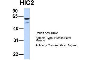 Host:  Rabbit  Target Name:  HIC2  Sample Type:  Human Fetal Muscle  Antibody Dilution:  1. (HIC2 antibody  (Middle Region))