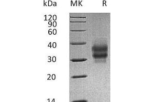 Folate Receptor 1 (Adult) (FOLR1) (AA 25-232) protein (His tag)
