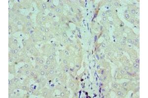 Immunohistochemistry of paraffin-embedded human liver tissue using ABIN7171193 at dilution of 1:100 (Syndecan 1 antibody  (AA 25-240))