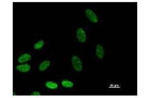 Immunostaining analysis in HeLa cells. (BAZ1B antibody)