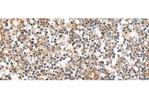 Immunohistochemistry of paraffin-embedded Human tonsil tissue using MRPS28 Polyclonal Antibody at dilution of 1:60(x200) (MRPS28 antibody)