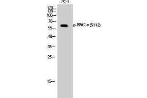 Western Blotting (WB) image for anti-Peroxisome Proliferator-Activated Receptor gamma (PPARG) (pSer112) antibody (ABIN3173013) (PPARG antibody  (pSer112))