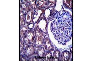 NPC1 Antibody (Center) (ABIN657395 and ABIN2846435) immunohistochemistry analysis in formalin fixed and paraffin embedded human kidney tissue followed by peroxidase conjugation of the secondary antibody and DAB staining. (NPC1 antibody  (AA 591-620))