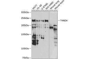 Western blot analysis of extracts of various cell lines, using THADA antibody (ABIN6133115, ABIN6149103, ABIN6149104 and ABIN6222943) at 1:1000 dilution. (THADA antibody  (AA 1684-1953))