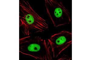 Immunofluorescent analysis of 4 % paraformaldehyde-fixed, 0. (EZH2 antibody  (N-Term))