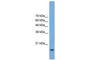 Image no. 1 for anti-Processing of Precursor 5, Ribonuclease P/MRP Subunit (POP5) (AA 71-120) antibody (ABIN6746471) (POP5 antibody  (AA 71-120))