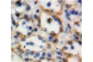 #VALUE! (TNFSF8 antibody  (AA 60-227))