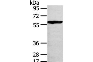 Western Blot analysis of 293T cell using THAP4 Polyclonal Antibody at dilution of 1/250 (THAP4 antibody)