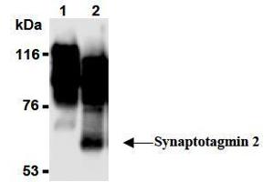 Western Blotting (WB) image for anti-Synaptotagmin II (SYT2) (AA 1-20), (N-Term) antibody (ABIN1449191)