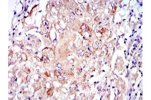 Immunohistochemistry (IHC) image for anti-Protein Kinase N2 (PKN2) antibody (ABIN969363)