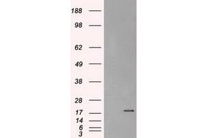 Image no. 2 for anti-Crystallin, alpha B (CRYAB) antibody (ABIN1497648)