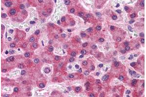 Human Liver: Formalin-Fixed, Paraffin-Embedded (FFPE) (SIPA1L2 antibody  (N-Term))