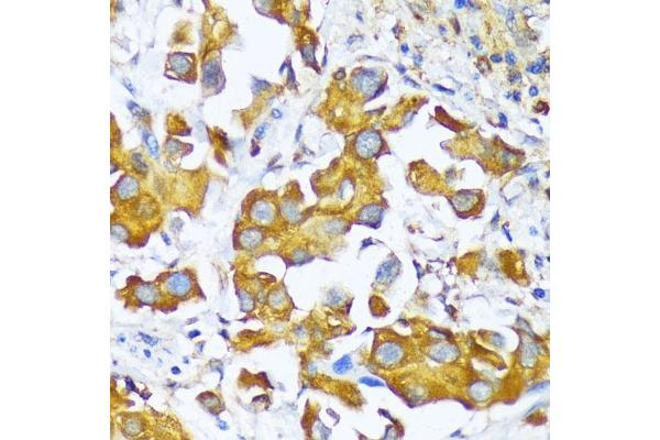 AARS antibody  (AA 1-100)