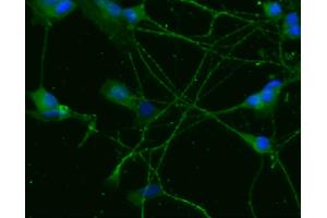 Immunofluorescent staining of differentiated SH-SY5Y cells (TRKB antibody  (AA 156-322))