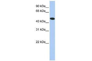 TXNDC5 antibody used at 1 ug/ml to detect target protein. (TXNDC5 antibody  (N-Term))