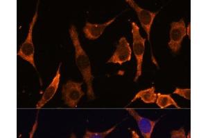 Immunofluorescence analysis of L929 cells using RPL36AL Polyclonal Antibody at dilution of 1:100 (40x lens). (RPL36AL antibody)