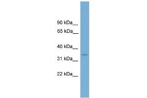 WB Suggested Anti-LUM Antibody Titration: 0. (LUM antibody  (Middle Region))