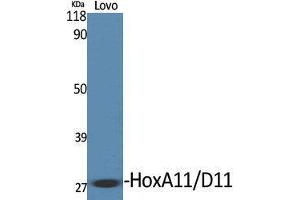 Western Blotting (WB) image for anti-Homeobox A11/D11 (HOXA11 + HOXD11) (C-Term) antibody (ABIN3175529) (HOXA11/D11 antibody  (C-Term))
