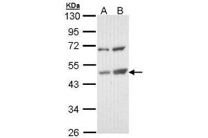 WB Image Sample (30 ug of whole cell lysate) A: Molt-4 , B: Raji 10% SDS PAGE antibody diluted at 1:1000 (TSPYL1 antibody)