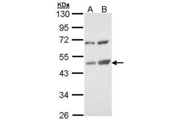 TSPYL1 antibody