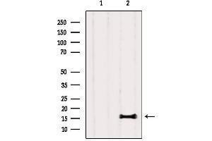 Western blot analysis of extracts from Rat lung, using PLA2G1B Antibody.