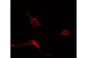 ABIN6274580 staining COLO205 cells by IF/ICC. (ADCY6 antibody  (Internal Region))