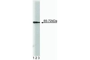 Western blot analysis of SHP2 (PTP1D) on a Jurkat cell lysate (Human T-cell leukemia, ATCC TIB-152). (PTPN11 antibody  (AA 1-177))