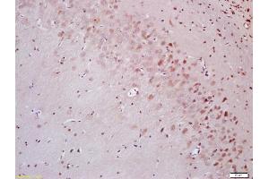 Formalin-fixed and paraffin embedded rat brain labeled with Anti-OCT1 Polyclonal Antibody, Unconjugated (ABIN737286) at 1:200 followed by conjugation to the secondary antibody and DAB staining (POU2F1 antibody  (C-Term))