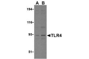 Image no. 1 for anti-Toll-Like Receptor 4 (TLR4) (N-Term) antibody (ABIN205943) (TLR4 antibody  (N-Term))