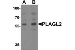Western blot analysis of PLAGL2 in rat brain tissue lysate with PLAGL2 Antibody  at (A) 1 and (B) 2 ug/ml. (PLAGL2 antibody  (N-Term))