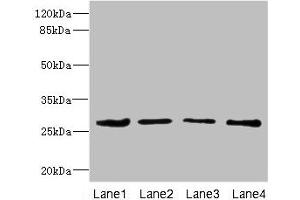 Western blot All lanes: DCXR antibody at 2. (DCXR antibody  (AA 1-244))