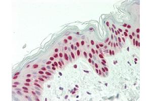 Human Skin: Formalin-Fixed, Paraffin-Embedded (FFPE) (NONO antibody  (AA 350-400))