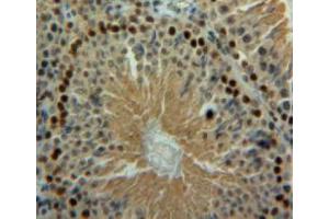 Used in DAB staining on fromalin fixed paraffin-embedded testis tissue (BLMH antibody  (AA 30-165))