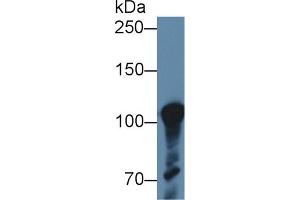 Detection of ABCF1 in Human K562 cell lysate using Polyclonal Antibody to ATP Binding Cassette Transporter F1 (ABCF1) (ABCF1 antibody  (AA 625-845))