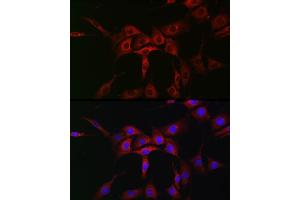 Immunofluorescence analysis of NIH/3T3 cells using  Rabbit pAb (ABIN7265789) at dilution of 1:50 (40x lens). (ATG12 antibody  (AA 1-74))