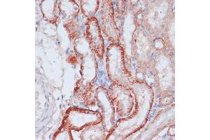 Immunohistochemistry of paraffin-embedded rat kidney using RPL31 antibody (ABIN7270002) at dilution of 1:100 (40x lens). (RPL31 antibody  (AA 5-105))
