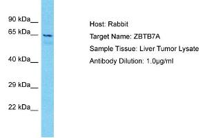 Host: Rabbit Target Name: ZBTB7A Sample Type: Liver Tumor lysates Antibody Dilution: 1. (ZBTB7A antibody  (N-Term))