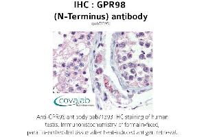 Image no. 2 for anti-G Protein-Coupled Receptor 98 (Gpr98) (Extracellular Domain), (N-Term) antibody (ABIN1735203) (Gpr98 antibody  (Extracellular Domain, N-Term))