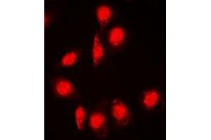 Immunofluorescent analysis of DPF2 staining in Jurkat cells. (DPF2 antibody)