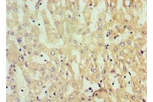 Immunohistochemistry of paraffin-embedded human liver tissue using ABIN7154755 at dilution of 1:100 (Nucleostemin antibody  (AA 1-240))